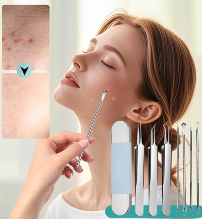 ⏳Time-Limited Special ⏰Stainless Steel Blackhead Remover Tool Kit