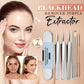 ⏳Time-Limited Special ⏰Stainless Steel Blackhead Remover Tool Kit